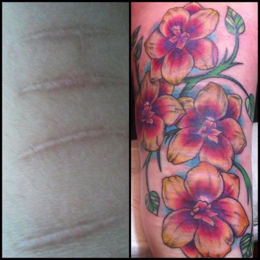scar-cover-up