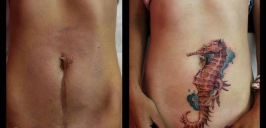 tatoo-cicatriz-cesarea