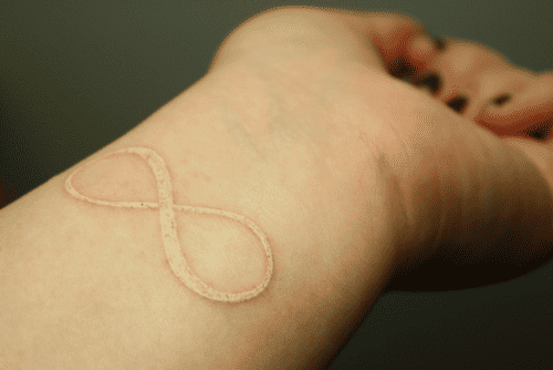 Tatuagem branca com um relevo bastante alto de um símbolo do infinito no pulso