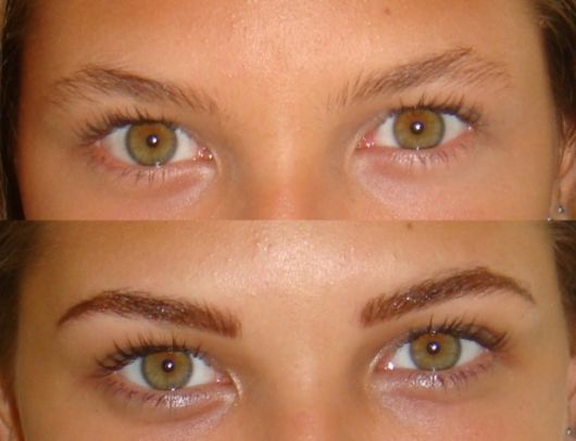 Antes e depois de mulher com olhos verdes.