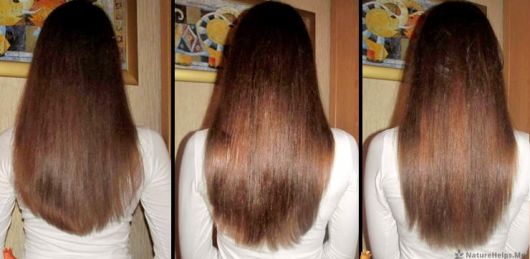fotos antes e depois cabelo crescimento