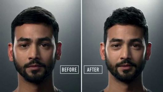 antes e depois de usar pomada