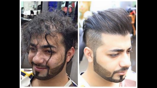 Progressiva masculina antes e depois
