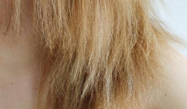 causas do cabelo poroso