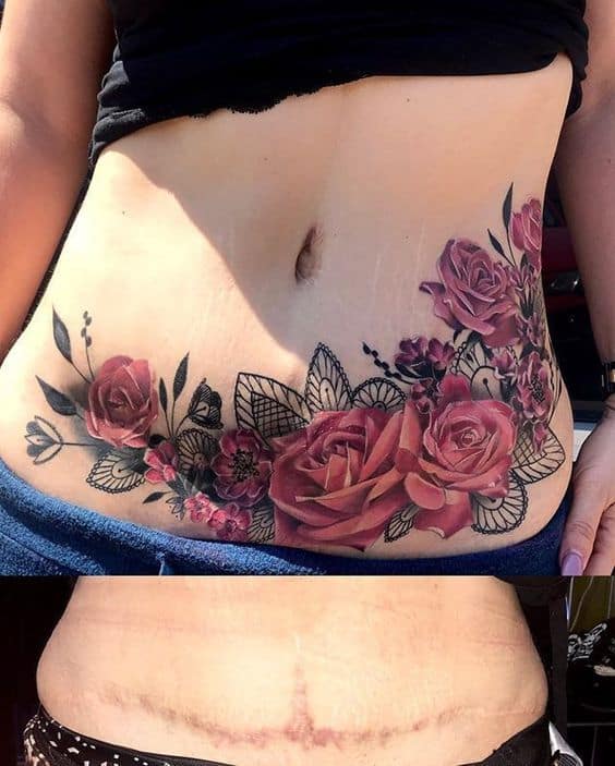 Rosas vermelhas tatuadas para esconder estrias